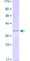 Human PMP22 Protein (Recombinant GST)