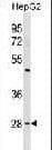 IHC-plus™ PHB / Prohibitin Antibody (aa92-121)