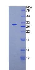 Mouse PLG / Plasmin / Plasminogen Protein (Recombinant His)