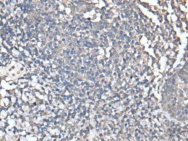 UBASH3A / CLIP4 Antibody