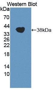 TRPA1 Antibody (aa63-370)