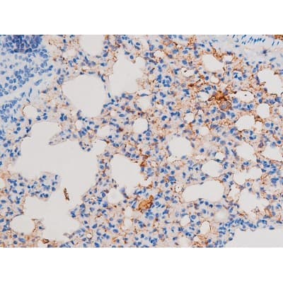 IRS1 Antibody (phospho-Ser639)