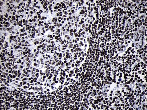 SMC1A / SMC1 Antibody (aa889-1016, clone OTI5A1)