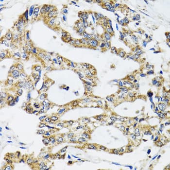PathPlus™ SSBP1 / mtSSB Antibody
