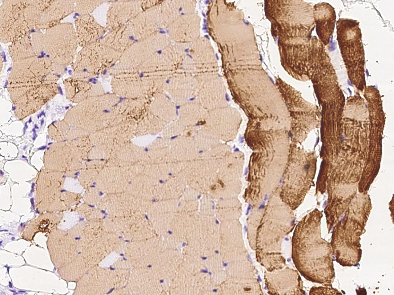 Polyclonal Rabbit anti-Human TNNI2 Antibody (Preservative Free, IHC, IF, WB)