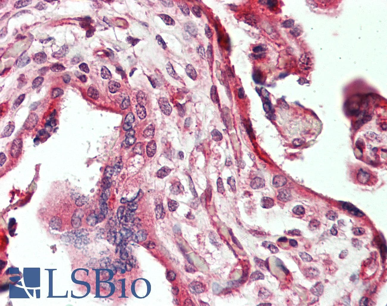 IHC-plus™ TNC / Tenascin C Antibody
