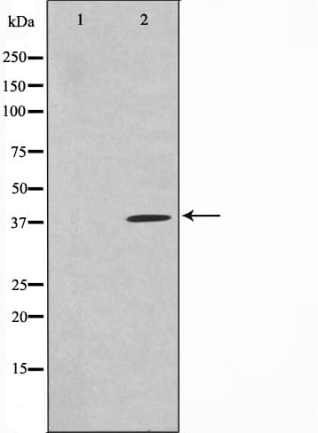 Polyclonal Rabbit anti-Human TNFSF11 / RANKL / TRANCE Antibody (IHC, IF, WB)