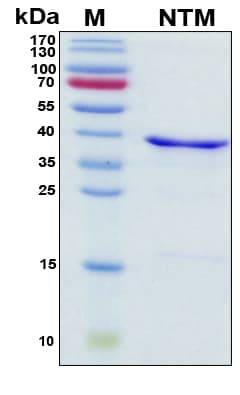 Human NTM / Neurotrimin Protein (Recombinant His, N-Terminal)