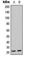 MRPL21 Antibody (Internal)