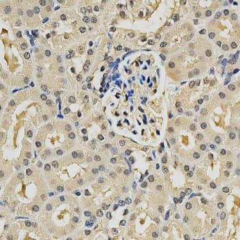 Polyclonal Rabbit anti-Human PSMB9 Antibody (IHC, IF, WB)