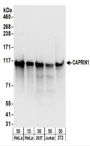 IHC-plus™ Polyclonal Rabbit anti-Human CAPRIN1 Antibody (aa450-500, IHC, WB)