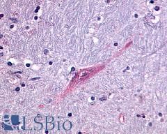 PathPlus™ GPR55 Antibody (C-Terminus)