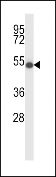 ZDHHC16 Antibody (aa286-314)
