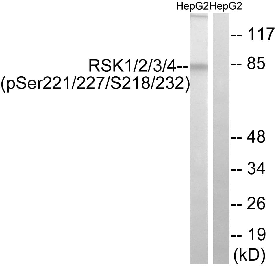 Polyclonal Rabbit anti-Human RSK1+2+3+4 Antibody (Ser221/Ser227/Ser218/Ser232, WB)