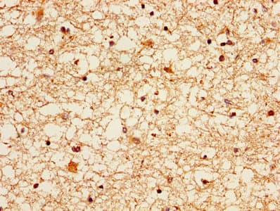 EZR / Ezrin Antibody