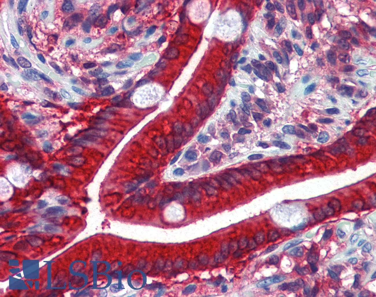 IHC-plus™ CES2 / Esterase Antibody (clone 4F12)