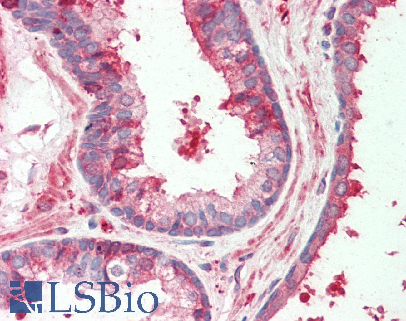 IHC-plus™ HAS2 Antibody (clone 4E7)