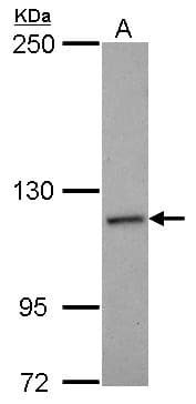 Polyclonal Rabbit anti-Human NCKAP1 / NAP125 Antibody (N-Terminus, IHC, WB)