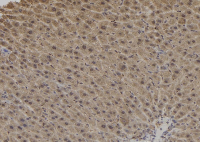 DCTN1 / Dynactin 1 Antibody