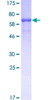 Human EML2 / EMAP2 Protein (Recombinant GST)