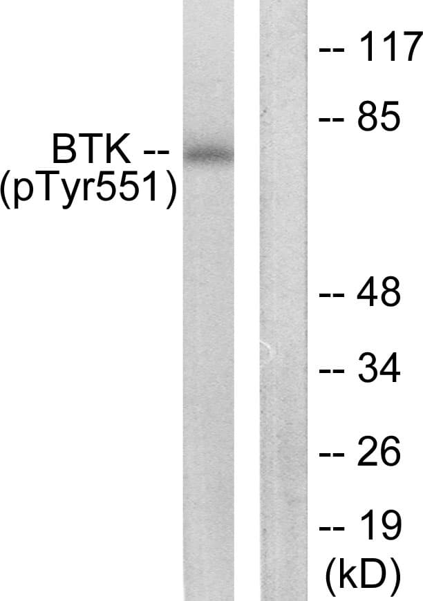 BTK Antibody (phospho-Tyr551)