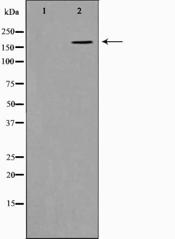 COL11A1 / Collagen XI Alpha 1 Antibody