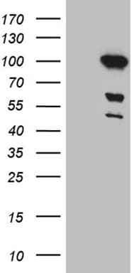 MLH1 Antibody (aa299-527, clone OTI4H6)