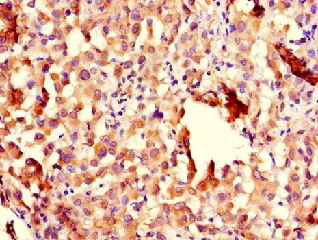 CHFR Antibody