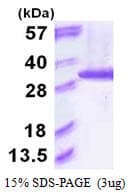 Human PSMA6 Protein (Recombinant His)