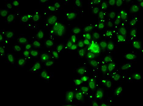 ATRIP Antibody