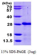 Human CIB2 / KIP2 Protein (Recombinant His)