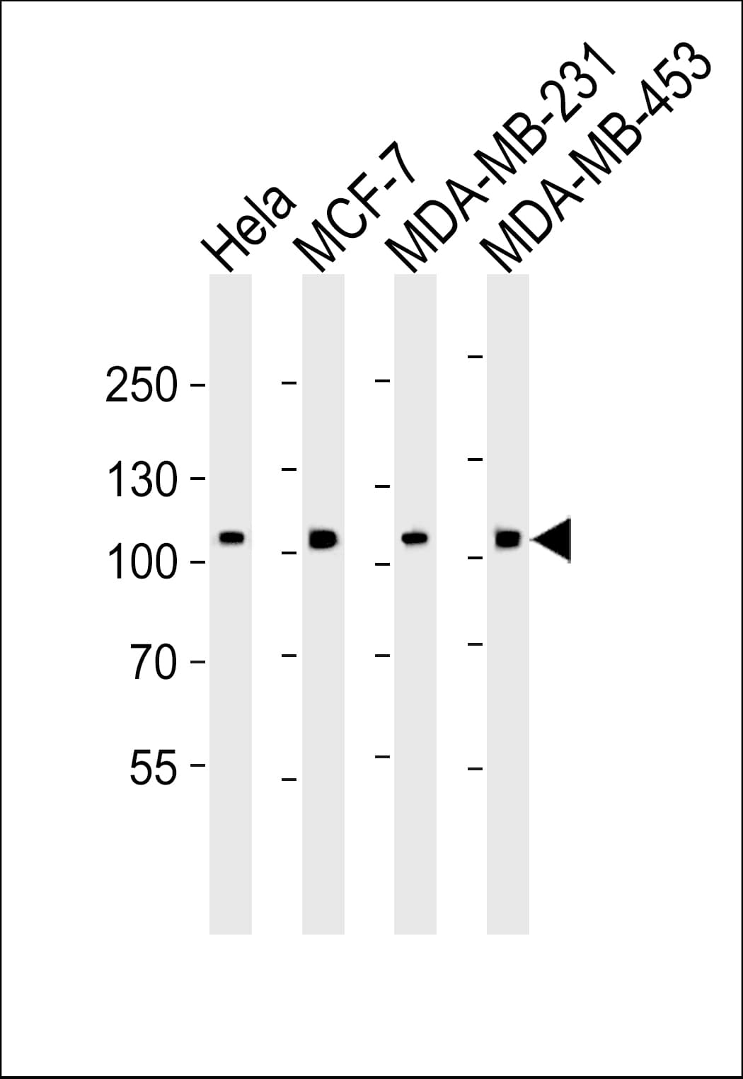 AFAP1 / AFAP Antibody (aa444-477)