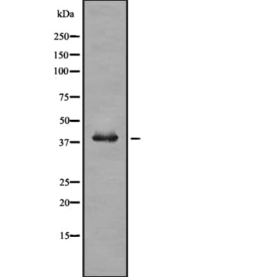 TRB3 / TRIB3 Antibody