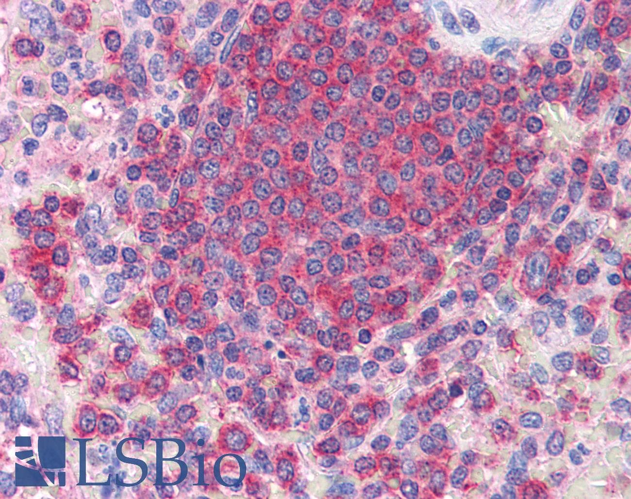 IHC-plus™ Polyclonal Goat anti-Human ARPC2 / p34-Arc Antibody (aa288-300, IHC, WB)