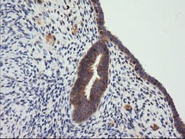Monoclonal Mouse anti-Human CTAG1B / NY-ESO-1 Antibody (clone OTI5H4, IHC, IF, WB)