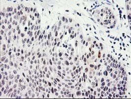 SERPINB13 / HUR7 Antibody (clone OTI2B6)