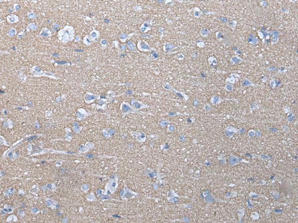 ETFB Antibody