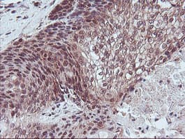 RFXANK Antibody (clone OTI2F12)
