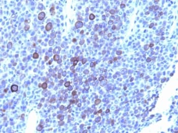 GPC3 / Glypican 3 Antibody (aa511-580, clone 1G12 + GPC3/863)