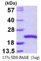 Human SNX3 Protein (Recombinant His)