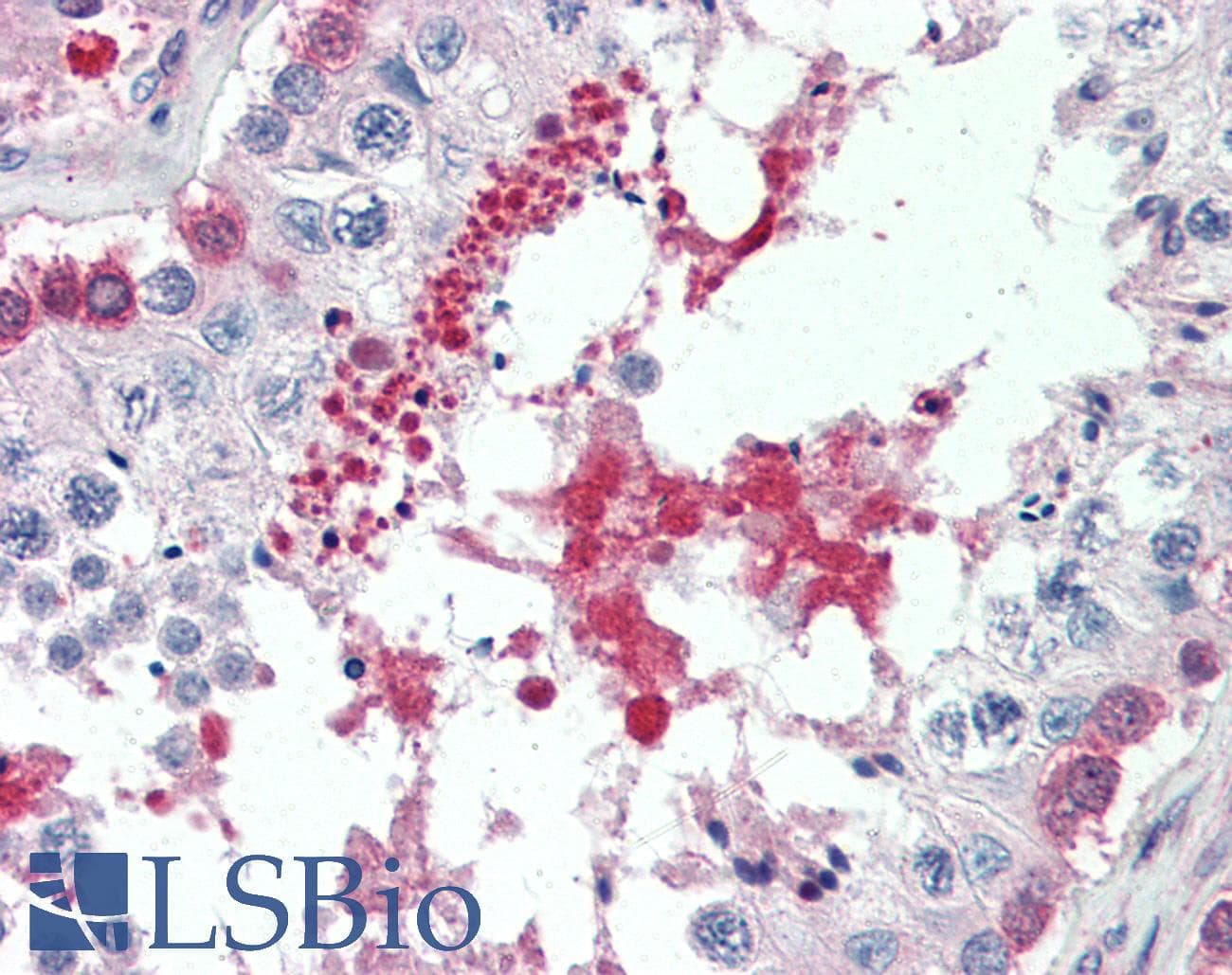 IHC-plus™ Polyclonal Goat anti-Human BAP / SIL1 Antibody (aa448-461, IHC, WB)