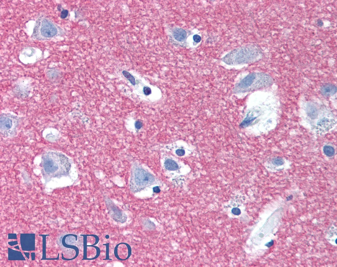 IHC-plus™ STX1A / Syntaxin 1A Antibody (Internal)