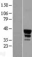 MEIS2 Protein (Over-Expression Lysate Myc-DDK (Flag))