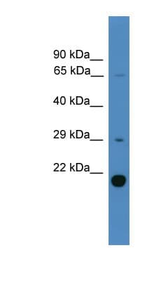 UBTD2 Antibody (C-Terminus)