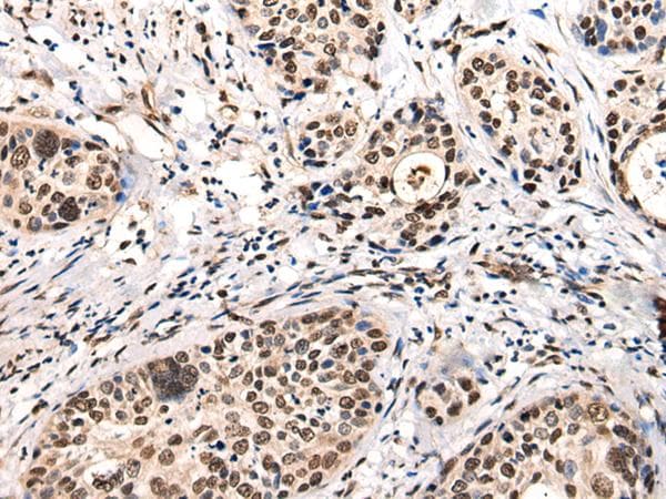 Polyclonal Rabbit anti-Human USP6NL Antibody (IHC, WB)