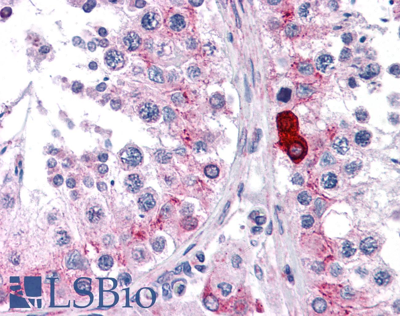 IHC-plus™ Polyclonal Rabbit anti-Human DCLK3 / CLR Antibody (IHC, IF, WB)