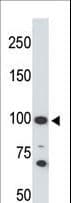 IHC-plus™ ACE2 / ACE-2 Antibody (aa773-805)