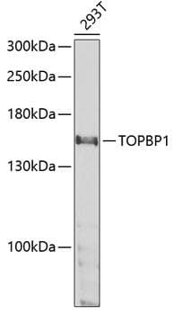 Polyclonal Rabbit anti-Human TOPBP1 Antibody (IHC, IF, WB)