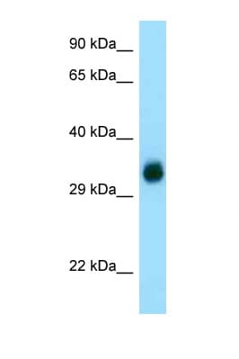 Polyclonal Rabbit anti-Human GGH / Gamma-Glutamyl Hydrolase Antibody (C-Terminus, IHC, WB)