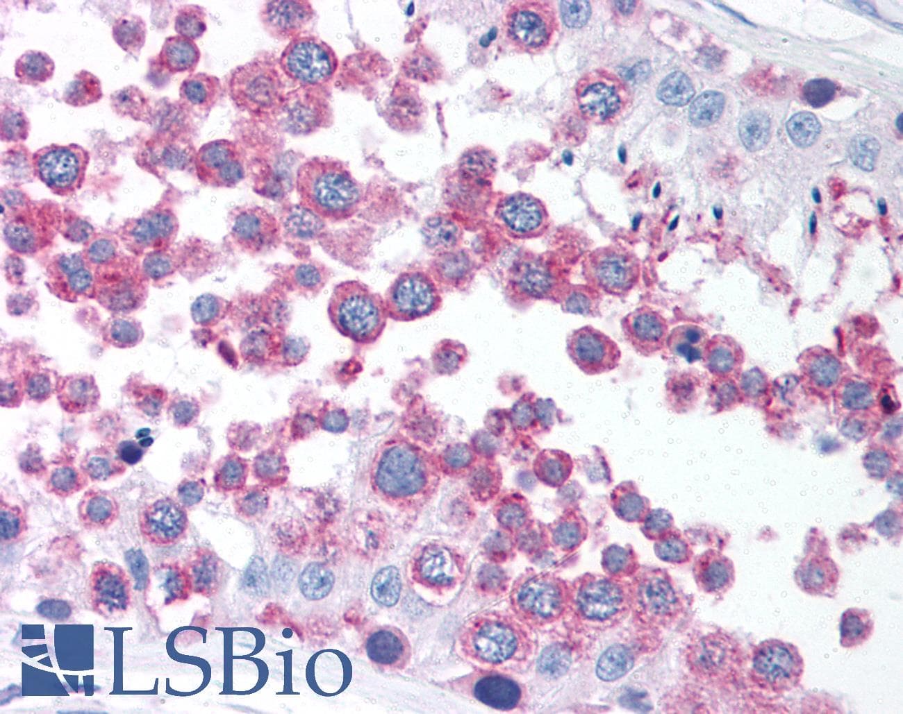 IHC-plus™ TUBG1 / Tubulin Gamma 1 Antibody (C-Terminus)